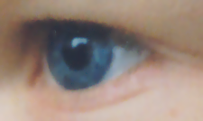 the Eye
